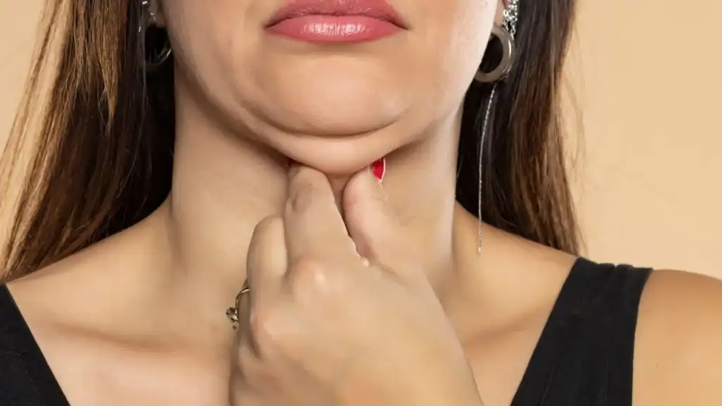 An image of a woman with double chin, sad, worried : Non Surgical Double Chin Removal Treatment in Malmesbury, UK