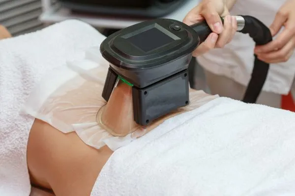 Image of person having fat freezing treatment to help weight gain Malmesbury