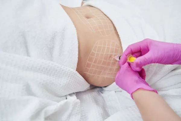 image of fat dissolving injections on love handles to help combat weight gain Malmesbury