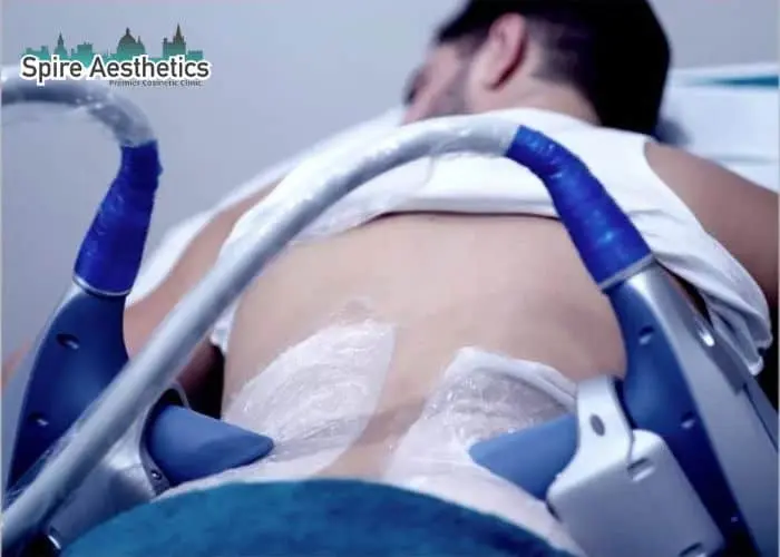 Man having fat freezing treatment done on love handles before a competitions Malmesbury to create a sculpted look.