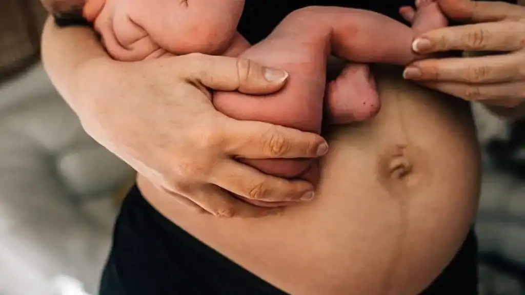 Why Is My Stomach Still Big After Pregnancy Malmesbury?